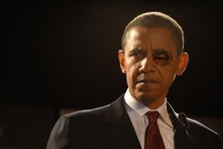 Obama's Black Eye Pictures, Images and Photos