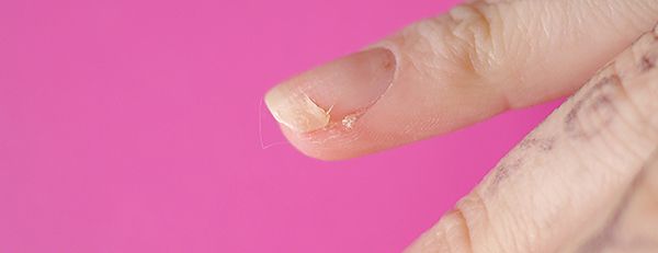 Herome SOS Nail Repair