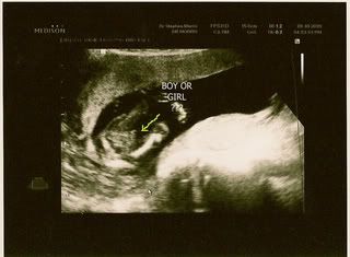 boy or girl ultrasound pic updated it s a boy pregnancy tips