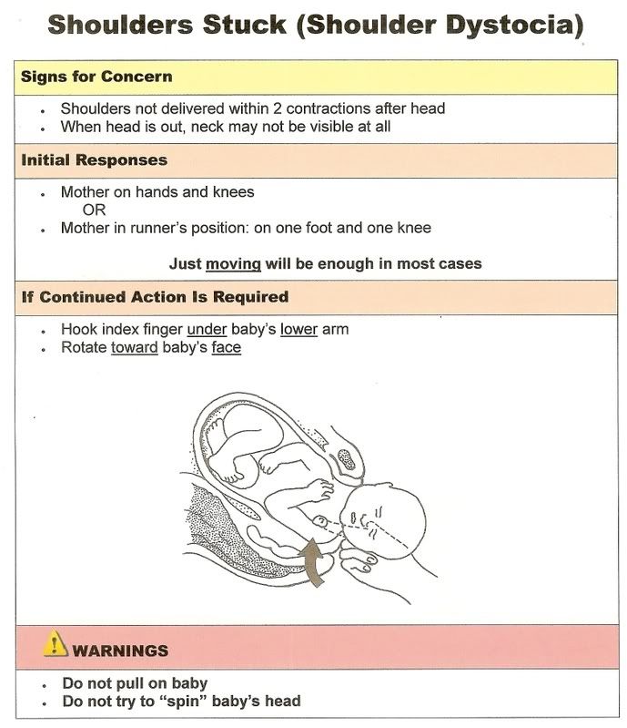 Shoulder dystocia in childbirth